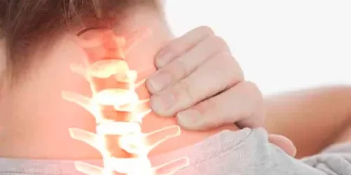 Radiculopatía-cervical