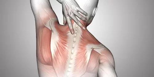 contracturas-musculares